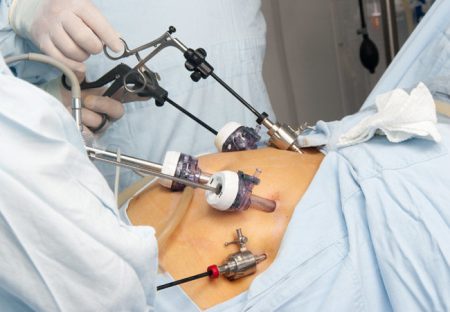 The Latest Advances in Bariatric Medicine and Surgery The Latest Advances in Bariatric Medicine and Surgery